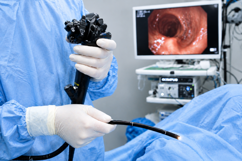 Home 3 Endoscopy mjoli