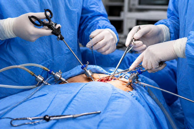 Home 5 Gastrointestinal Surgery 1