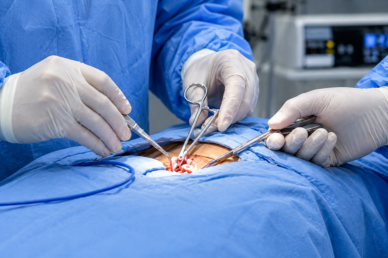 Home 4 mjoli Colorectal Surgery